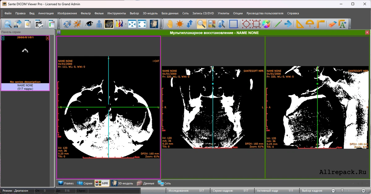 Sante DICOM Viewer — изображение 1
