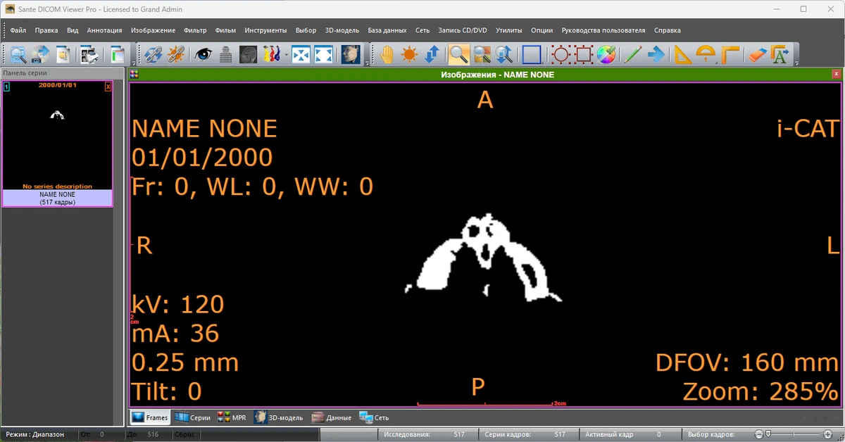 Sante DICOM Viewer